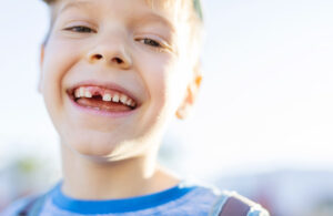 TREATMENT OPTIONS FOR THE TEETH GAPS Picture