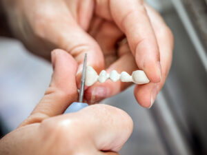 NEED-TO-KNOW DENTAL TREATMENT OPTIONS IN TURKEY Picture