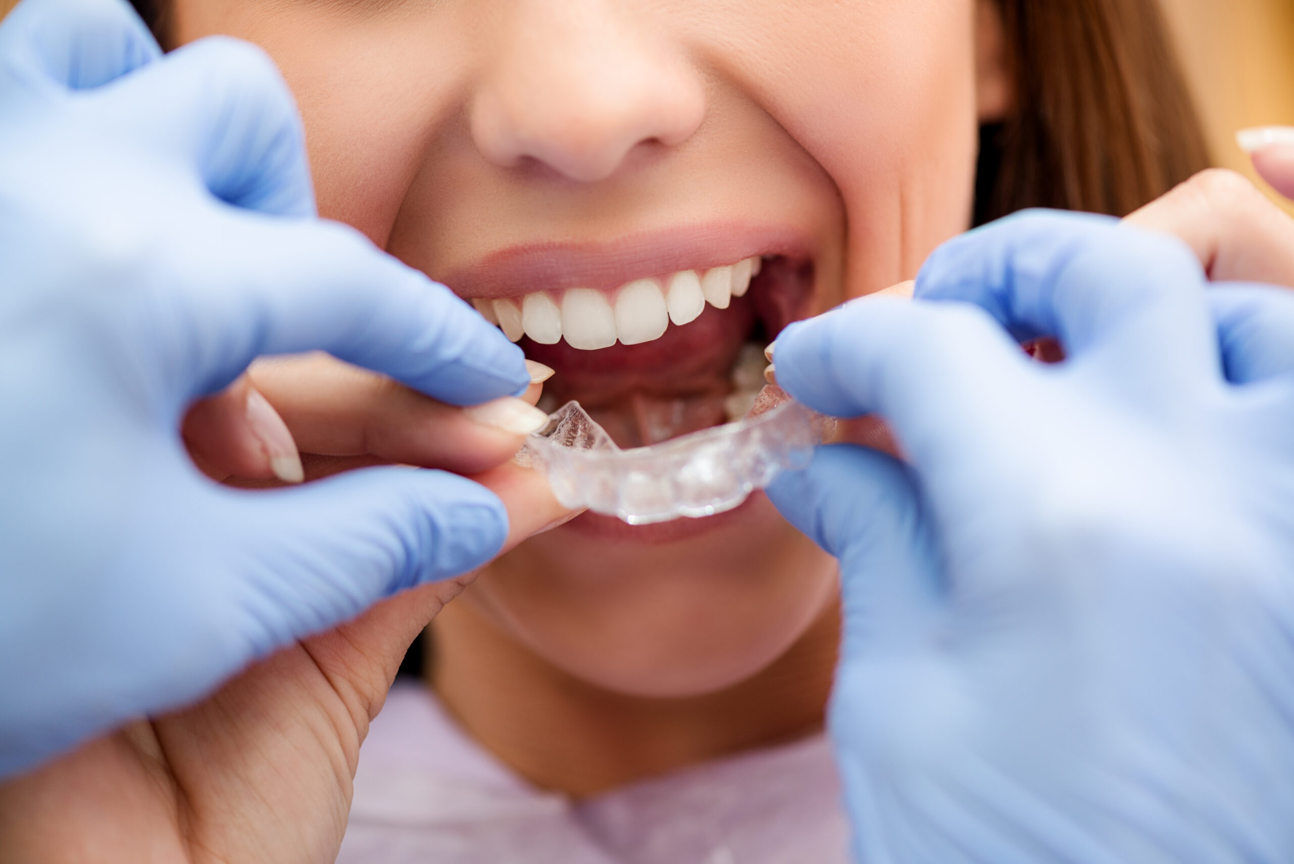 ORTHODONTIC TREATMENTS FOR ALL AGES IN TURKEY