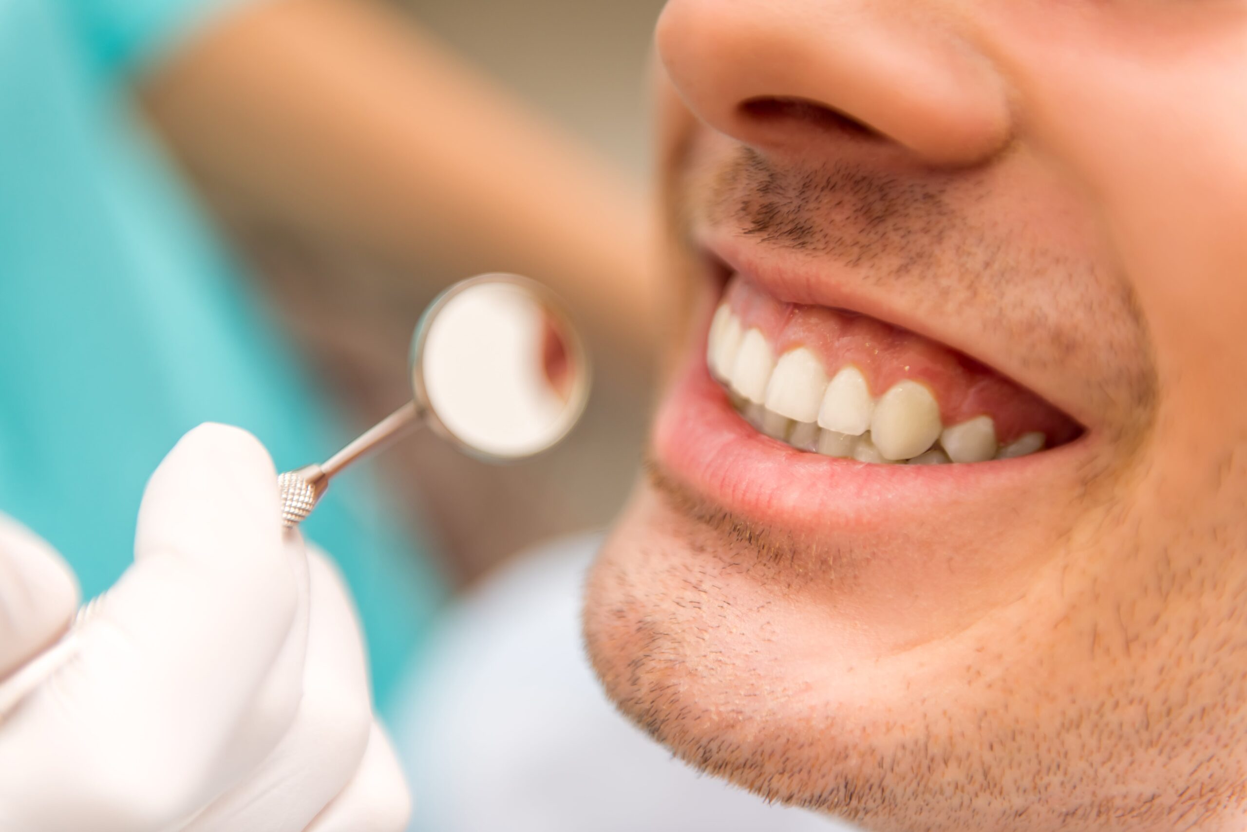 WHAT HAPPENS TO VENEERS AFTER 10 YEARS?