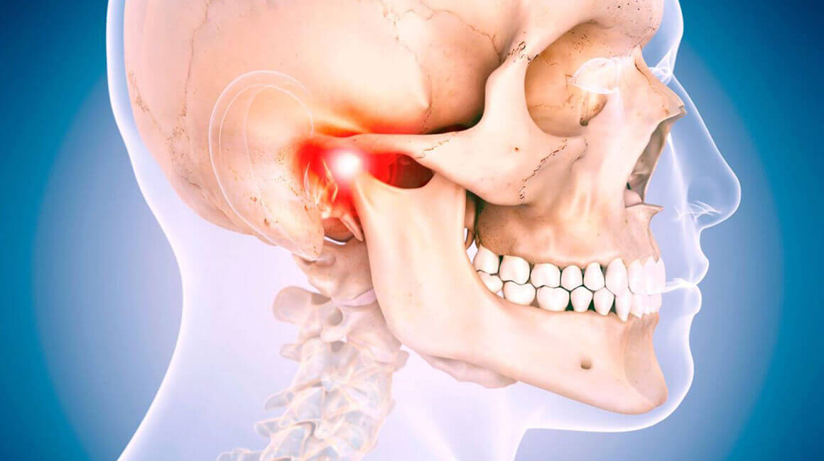 JAW JOINT DISEASES
