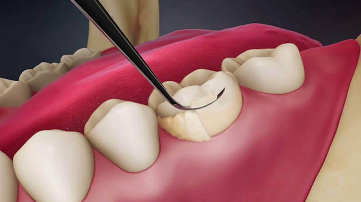 أمراض الأسنان و علاجها 